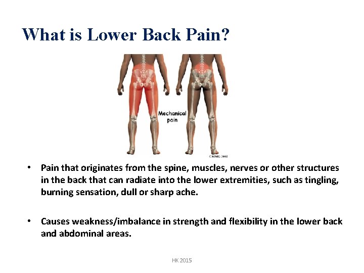 What is Lower Back Pain? • Pain that originates from the spine, muscles, nerves