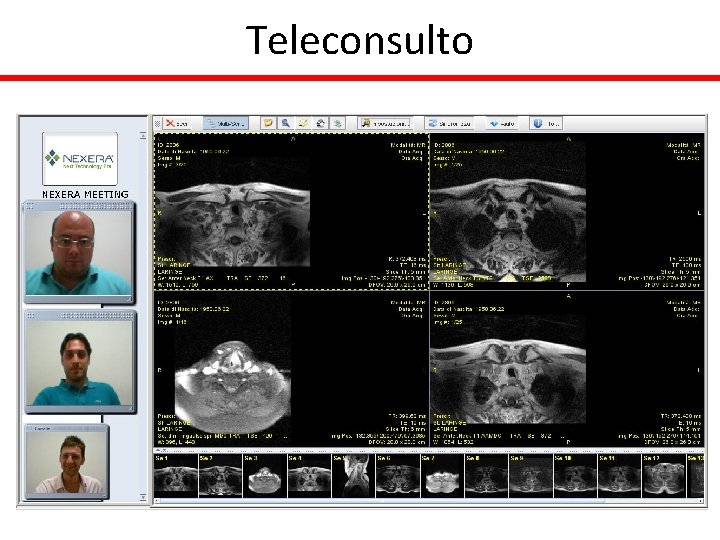 Teleconsulto 