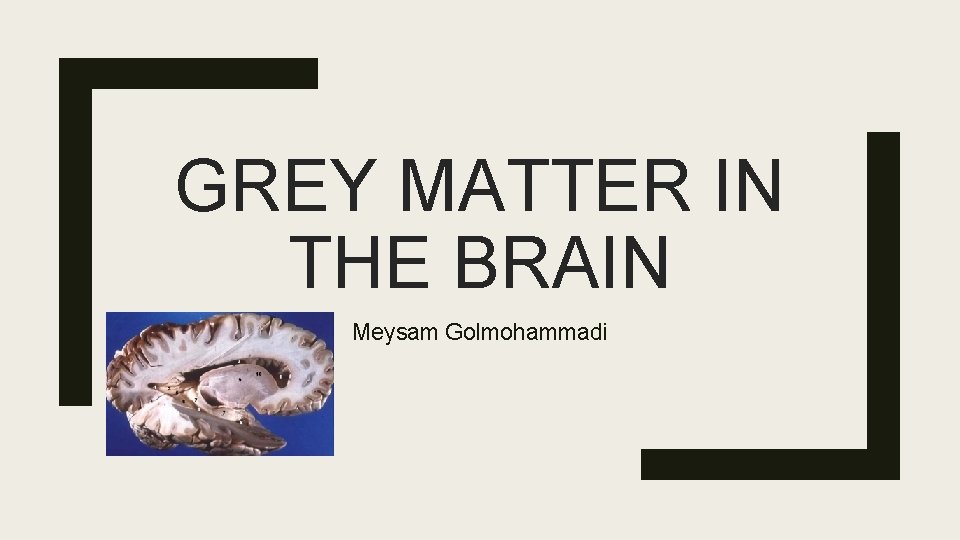 GREY MATTER IN THE BRAIN Meysam Golmohammadi 