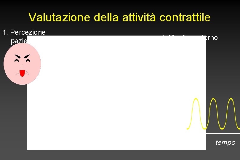 Valutazione della attività contrattile 1. Percezione paziente 4. Monitor esterno mm. Hg 2. Valutazione