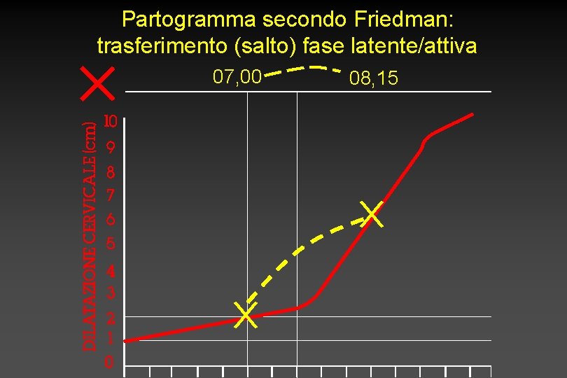 Partogramma secondo Friedman: trasferimento (salto) fase latente/attiva 07, 00 08, 15 