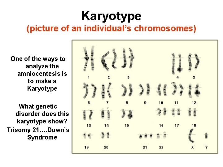Karyotype (picture of an individual’s chromosomes) One of the ways to analyze the amniocentesis