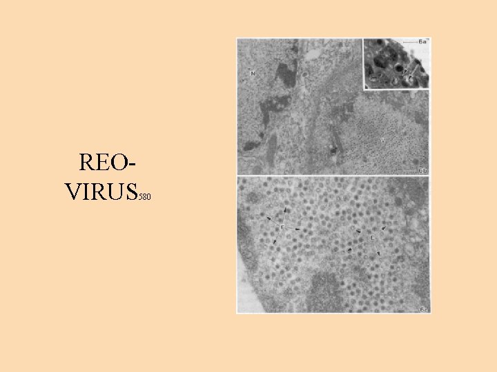 REOVIRUS 580 
