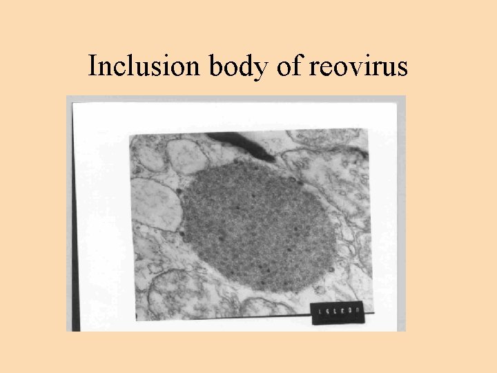 Inclusion body of reovirus 