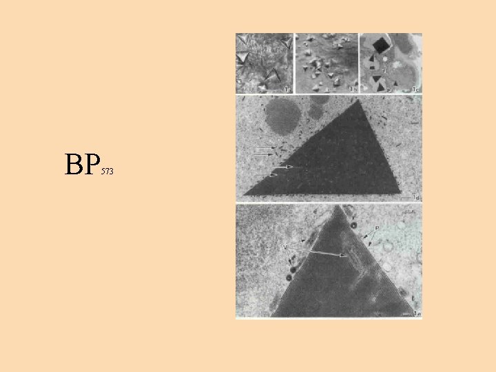 BP 573 