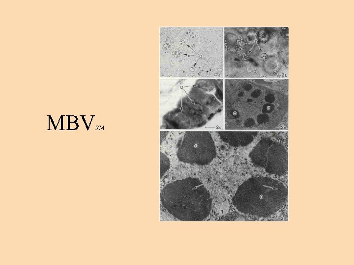 MBV 574 