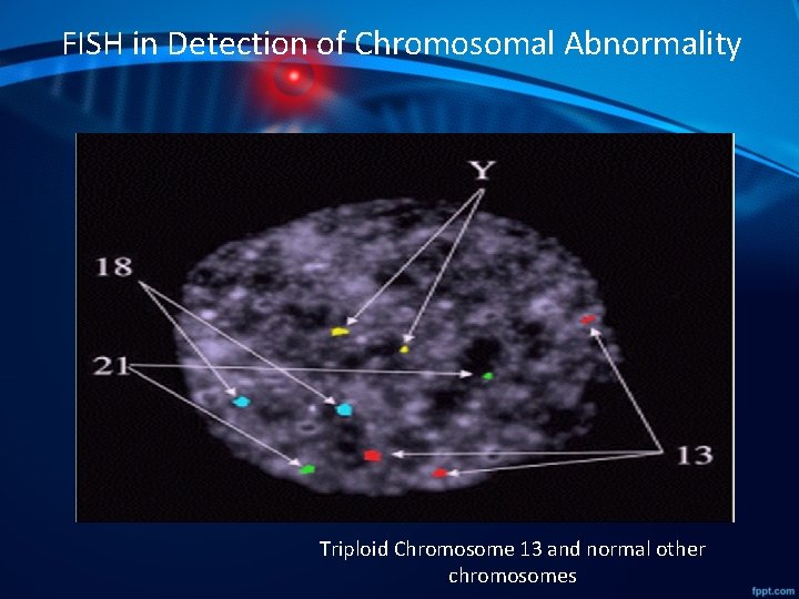 FISH in Detection of Chromosomal Abnormality Triploid Chromosome 13 and normal other chromosomes FISH in Detection of Chromosomal Abnormality Triploid Chromosome 13 and normal other chromosomes