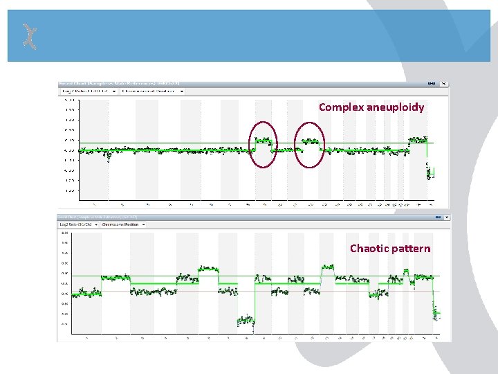 Complex aneuploidy Chaotic pattern Complex aneuploidy Chaotic pattern