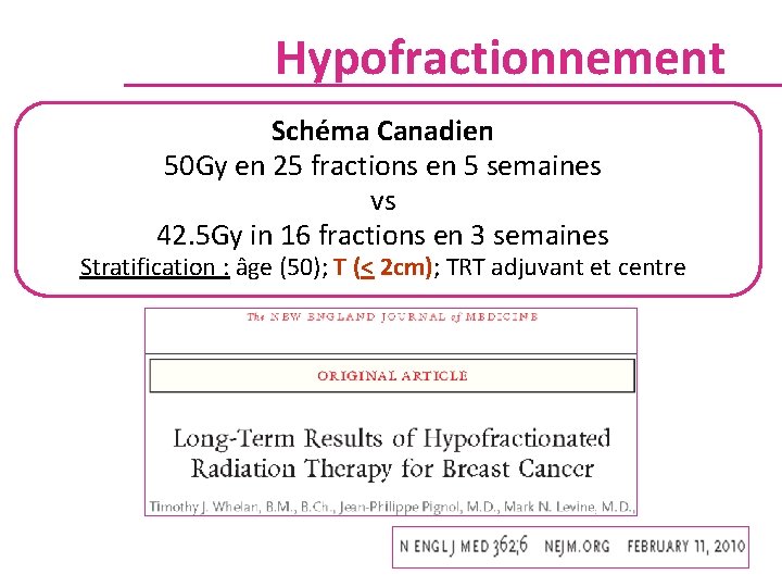 Hypofractionnement Schéma Canadien 50 Gy en 25 fractions en 5 semaines vs 42. 5