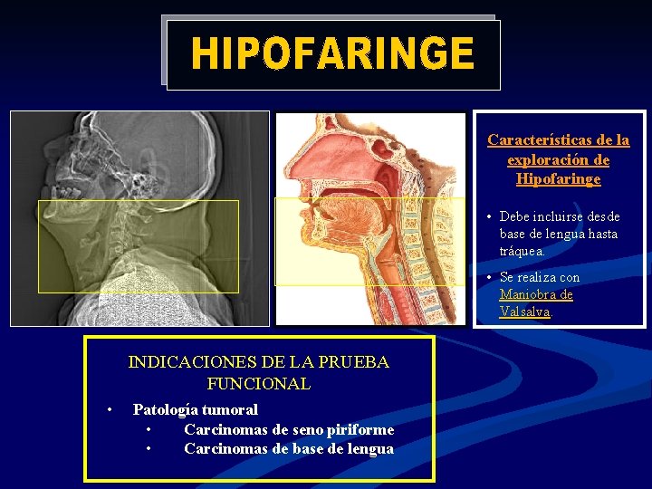 Características de la exploración de Hipofaringe • Debe incluirse desde base de lengua hasta