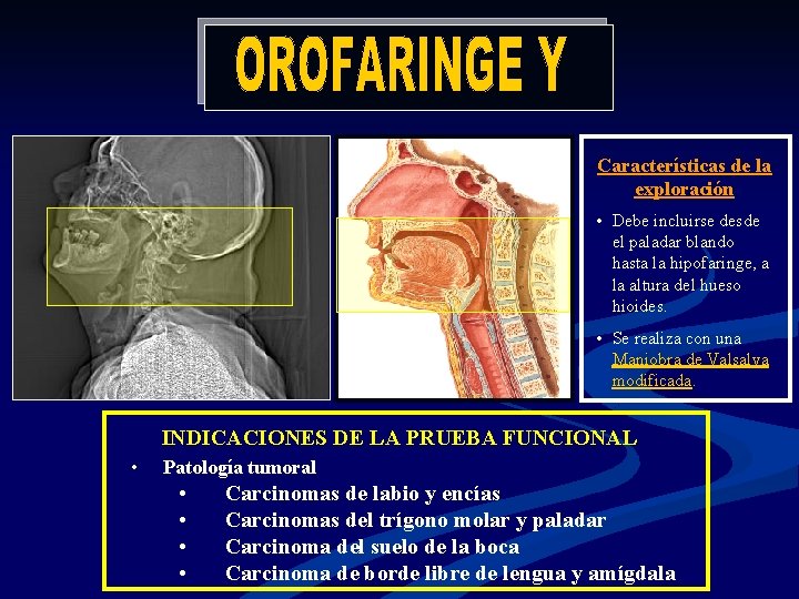 Características de la exploración • Debe incluirse desde el paladar blando hasta la hipofaringe,