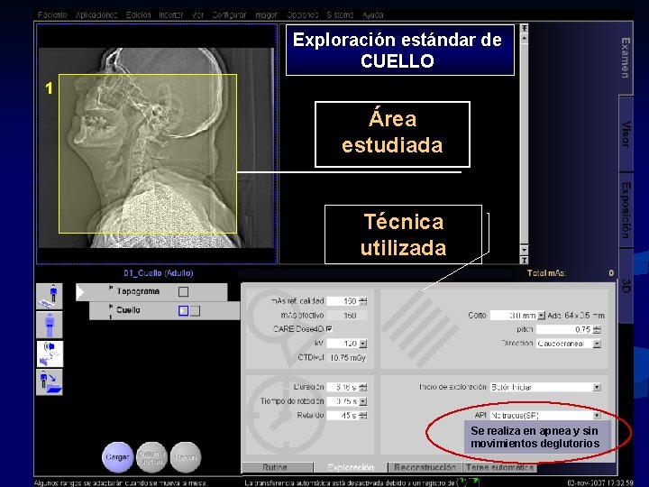 Exploración estándar de CUELLO 1 Área estudiada Técnica utilizada Se realiza en apnea y