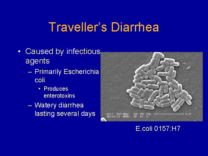 Traveller’s Diarrhea • Caused by infectious agents – Primarily Escherichia coli • Produces enterotoxins