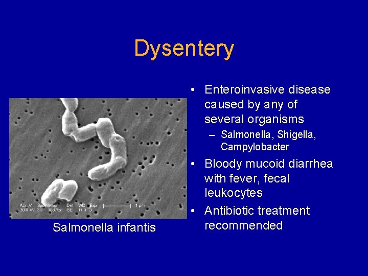 Dysentery • Enteroinvasive disease caused by any of several organisms – Salmonella, Shigella, Campylobacter