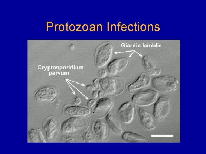 Protozoan Infections 