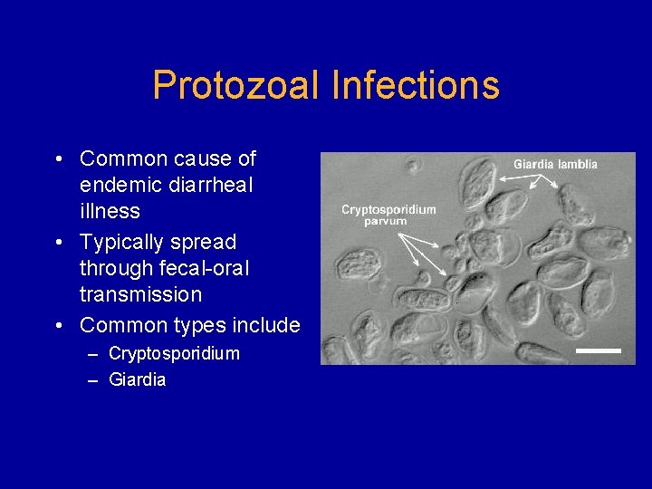 Protozoal Infections • Common cause of endemic diarrheal illness • Typically spread through fecal-oral