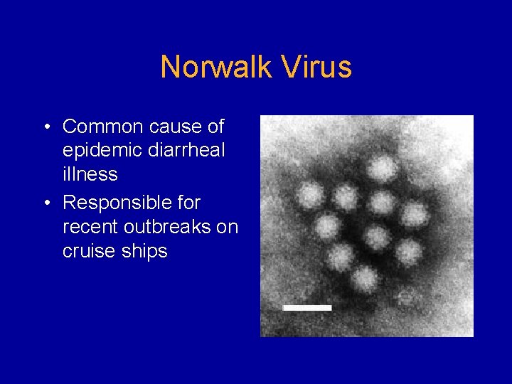 Norwalk Virus • Common cause of epidemic diarrheal illness • Responsible for recent outbreaks