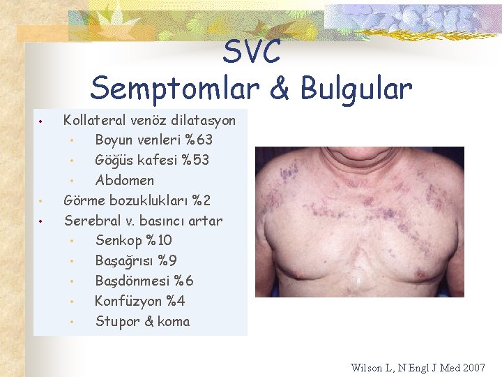 SVC Semptomlar & Bulgular • • • Kollateral venöz dilatasyon • Boyun venleri %63