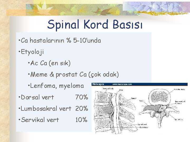 Spinal Kord Basısı • Ca hastalarının % 5 -10’unda • Etyoloji • Ac Ca