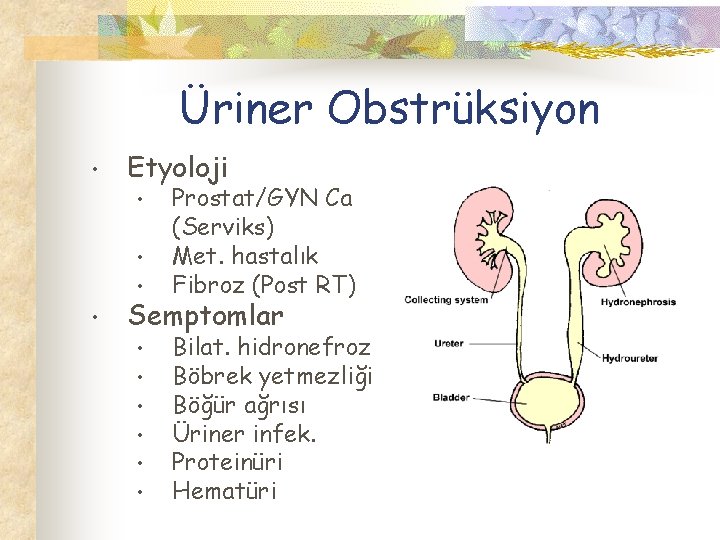 Üriner Obstrüksiyon • Etyoloji • • Prostat/GYN Ca (Serviks) Met. hastalık Fibroz (Post RT)