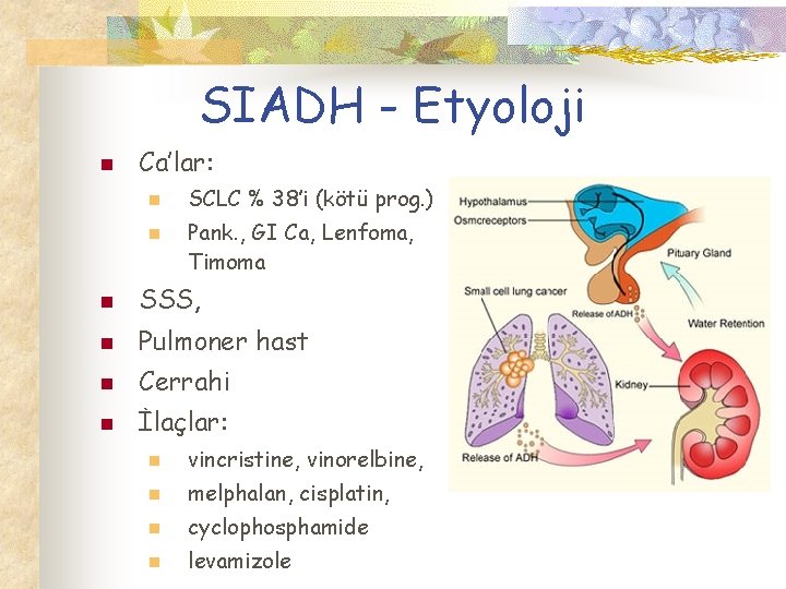 SIADH - Etyoloji n Ca’lar: n n SCLC % 38’i (kötü prog. ) Pank.