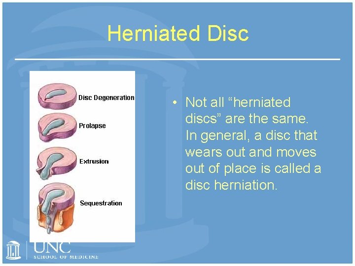 Herniated Disc • Not all “herniated discs” are the same. In general, a disc