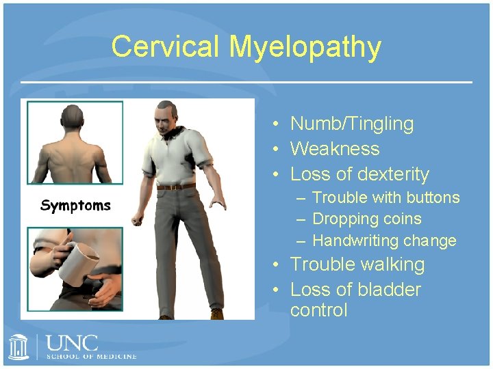 Cervical Myelopathy • Numb/Tingling • Weakness • Loss of dexterity – Trouble with buttons