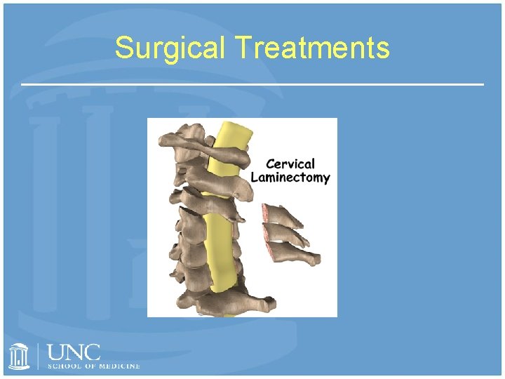 Surgical Treatments 