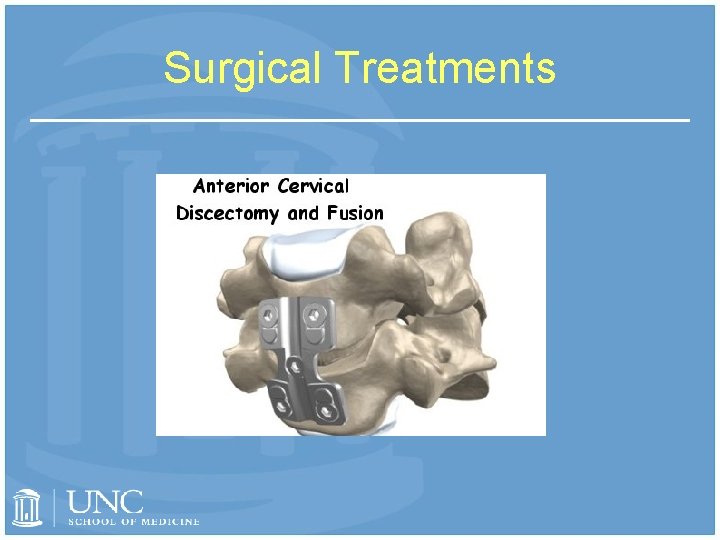 Surgical Treatments 