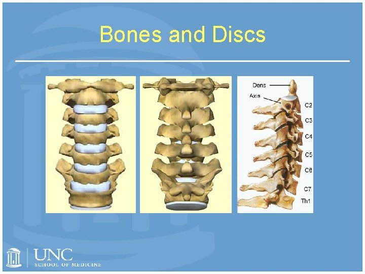 Bones and Discs 