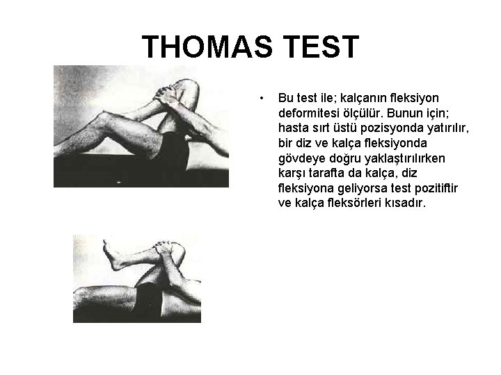 THOMAS TEST • Bu test ile; kalçanın fleksiyon deformitesi ölçülür. Bunun için; hasta sırt