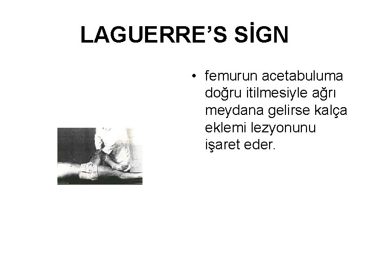LAGUERRE’S SİGN • femurun acetabuluma doğru itilmesiyle ağrı meydana gelirse kalça eklemi lezyonunu işaret