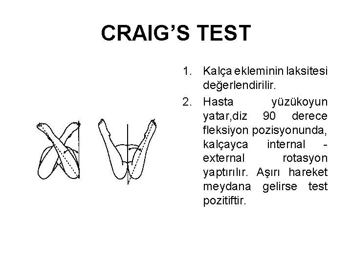 CRAIG’S TEST 1. Kalça ekleminin laksitesi değerlendirilir. 2. Hasta yüzükoyun yatar, diz 90 derece