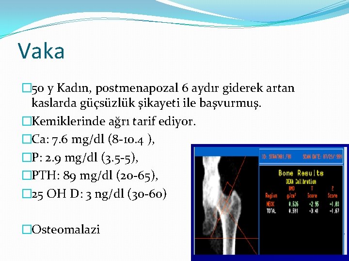 Vaka � 50 y Kadın, postmenapozal 6 aydır giderek artan kaslarda güçsüzlük şikayeti ile