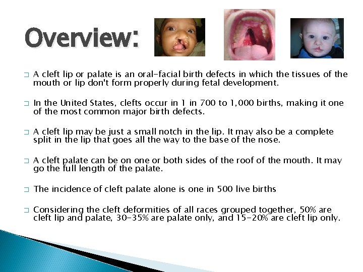 Overview: � � � � A cleft lip or palate is an oral-facial birth