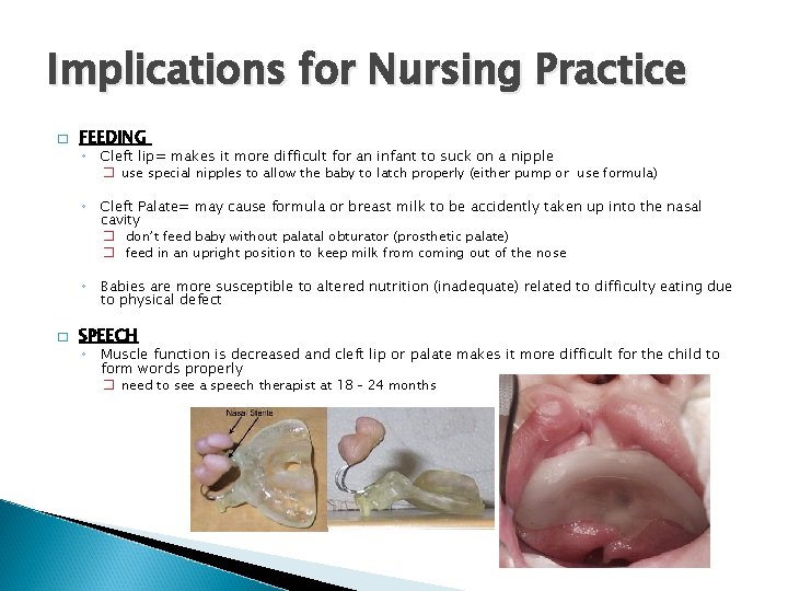 Implications for Nursing Practice � FEEDING ◦ Cleft lip= makes it more difficult for