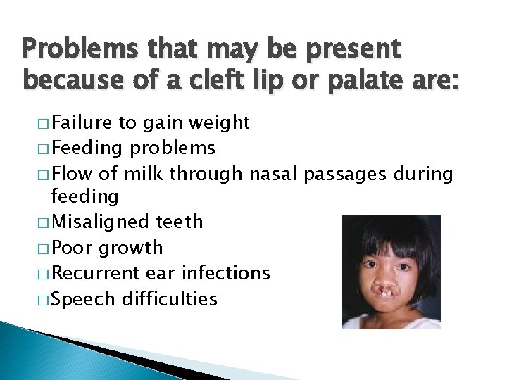 Problems that may be present because of a cleft lip or palate are: �