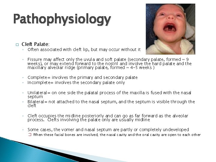 Pathophysiology � Cleft Palate: ◦ Often associated with cleft lip, but may occur without