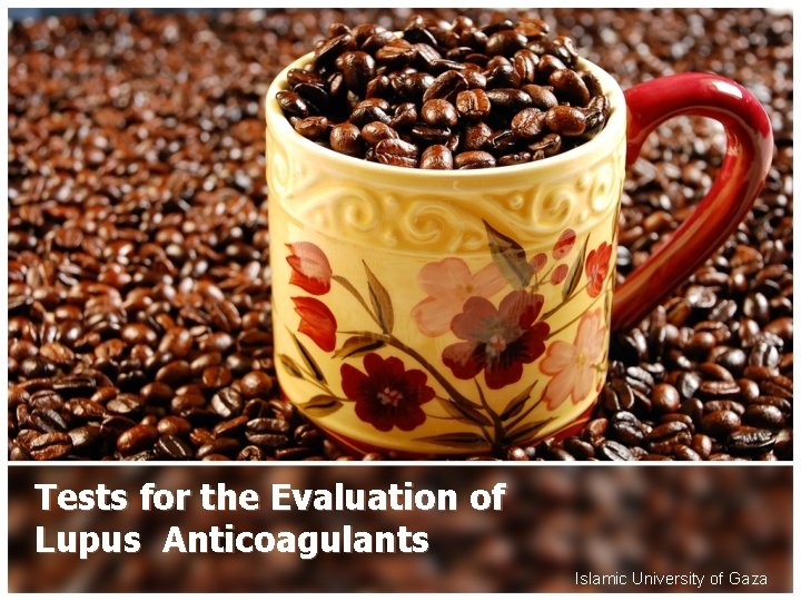 Tests for the Evaluation of Lupus Anticoagulants Islamic University of Gaza 
