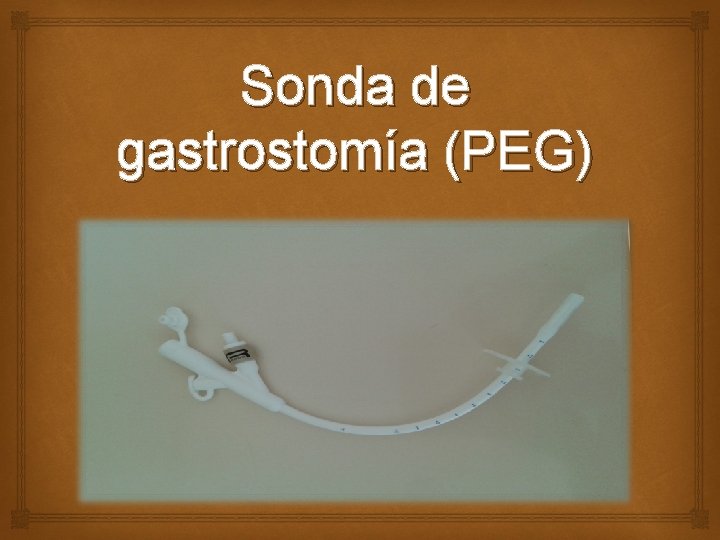 Sonda de gastrostomía (PEG) 
