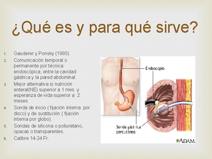 ¿Qué es y para qué sirve? 1. 2. 3. 4. 5. 6. Gauderer y