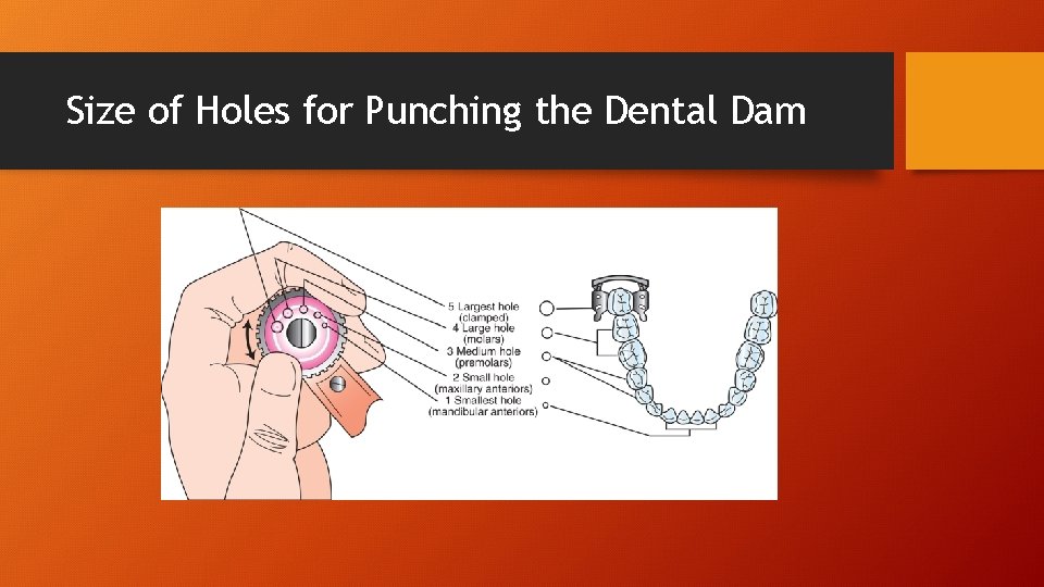Size of Holes for Punching the Dental Dam 