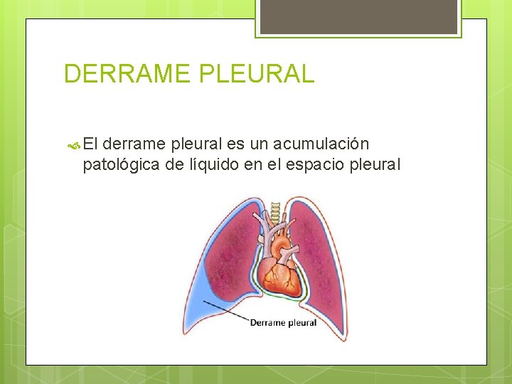 DERRAME PLEURAL El derrame pleural es un acumulación patológica de líquido en el espacio DERRAME PLEURAL El derrame pleural es un acumulación patológica de líquido en el espacio