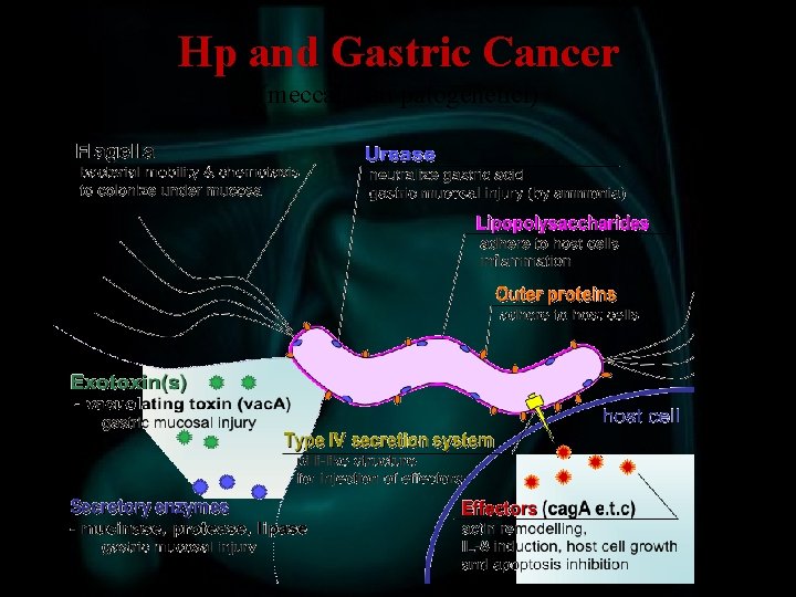 Hp and Gastric Cancer (meccanismi patogenetici) 