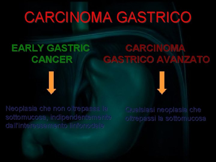 CARCINOMA GASTRICO EARLY GASTRIC CANCER CARCINOMA GASTRICO AVANZATO Neoplasia che non oltrepassa la sottomucosa,