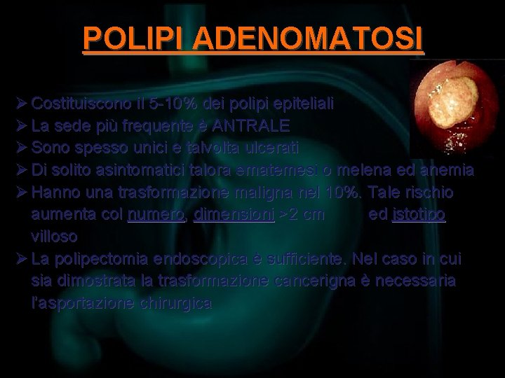 POLIPI ADENOMATOSI Ø Costituiscono il 5 -10% dei polipi epiteliali Ø La sede più