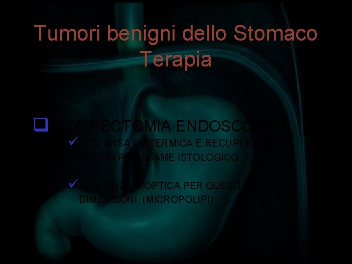 Tumori benigni dello Stomaco Terapia q POLIPECTOMIA ENDOSCOPICA üCON ANSA DIATERMICA E RECUPERO DEL