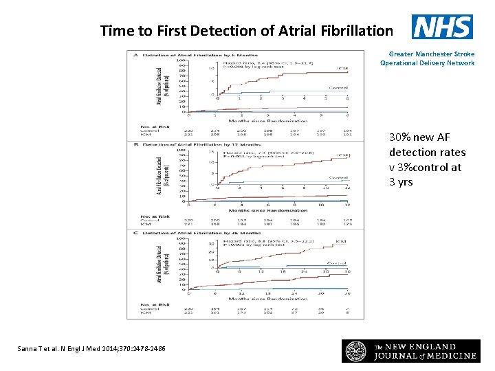 Time to First Detection of Atrial Fibrillation Greater Manchester Stroke Operational Delivery Network 30%