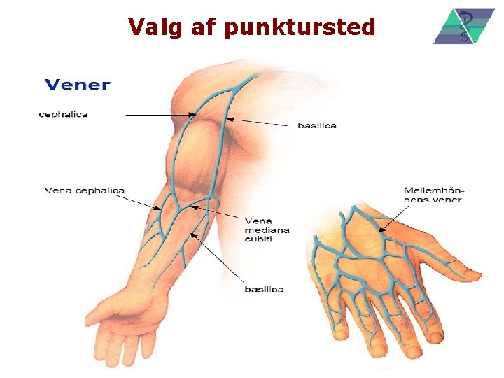 Valg af punktursted 