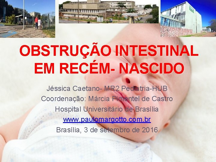 OBSTRUÇÃO INTESTINAL EM RECÉM- NASCIDO Jéssica Caetano- MR 2 Pediatria-HUB Coordenação: Márcia Pimentel de